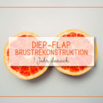 DIEP-Flap Brustrekonstruktion - 1 Jahr danach